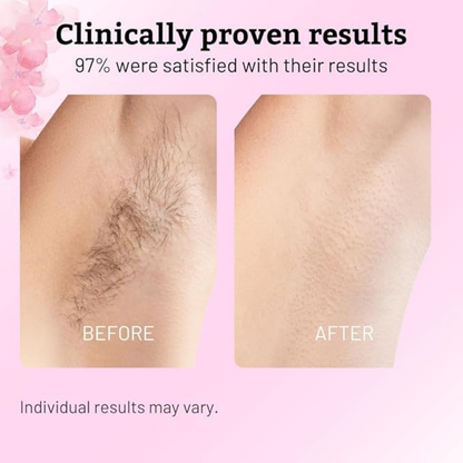 Cyperus Rotundus Hair Reduction Oil